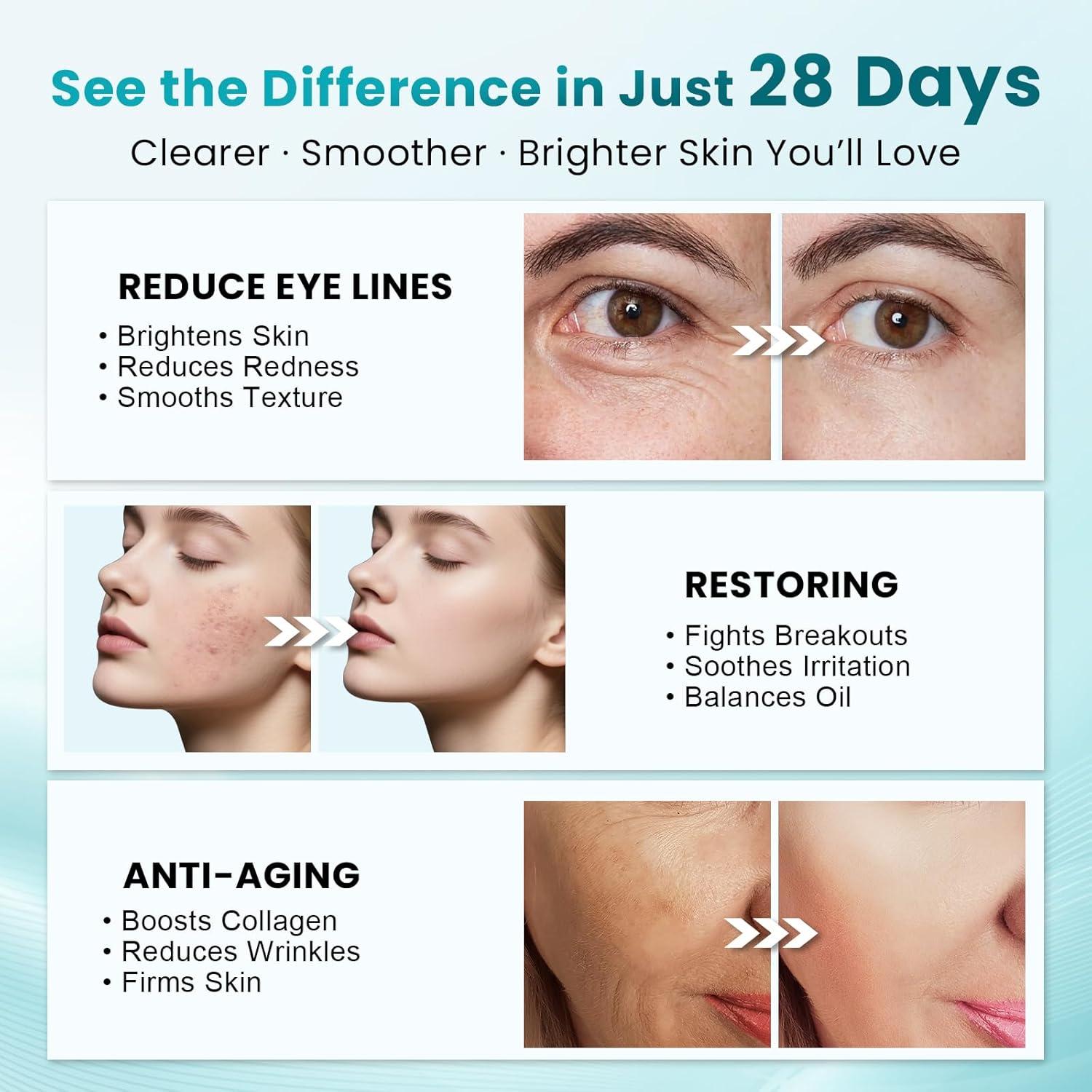 Máscara de Terapia de Luz Roja Inalámbrica Lovsheme 320 LEDs