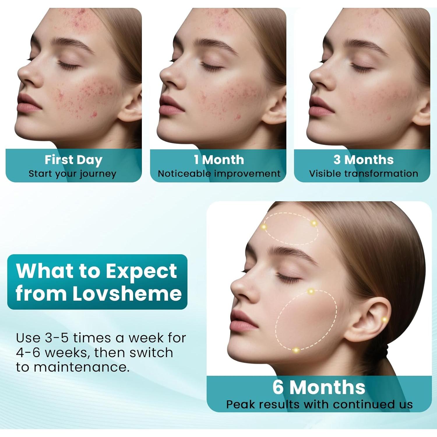 Máscara de Terapia de Luz Roja Inalámbrica Lovsheme 320 LEDs