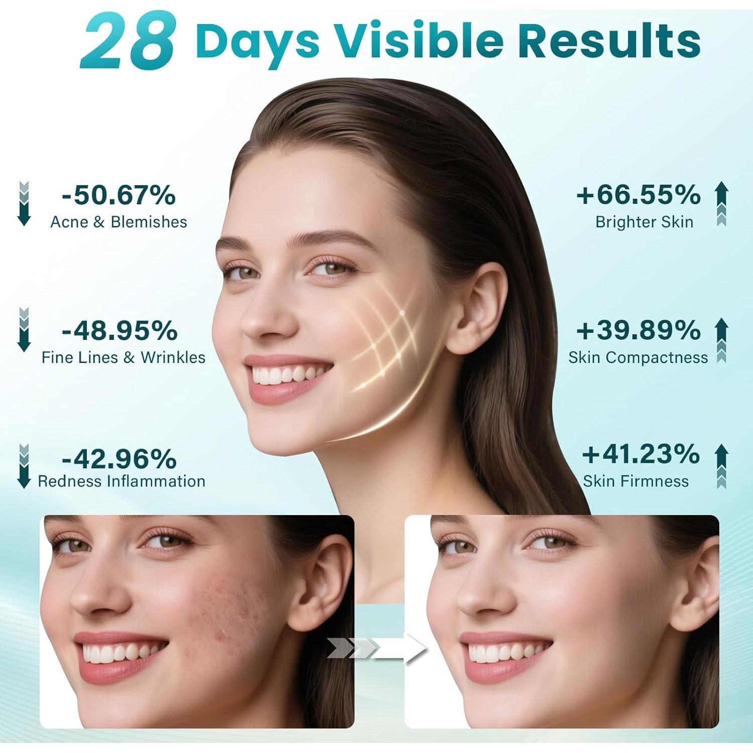 Máscara de Terapia de Luz Roja Inalámbrica Lovsheme 320 LEDs