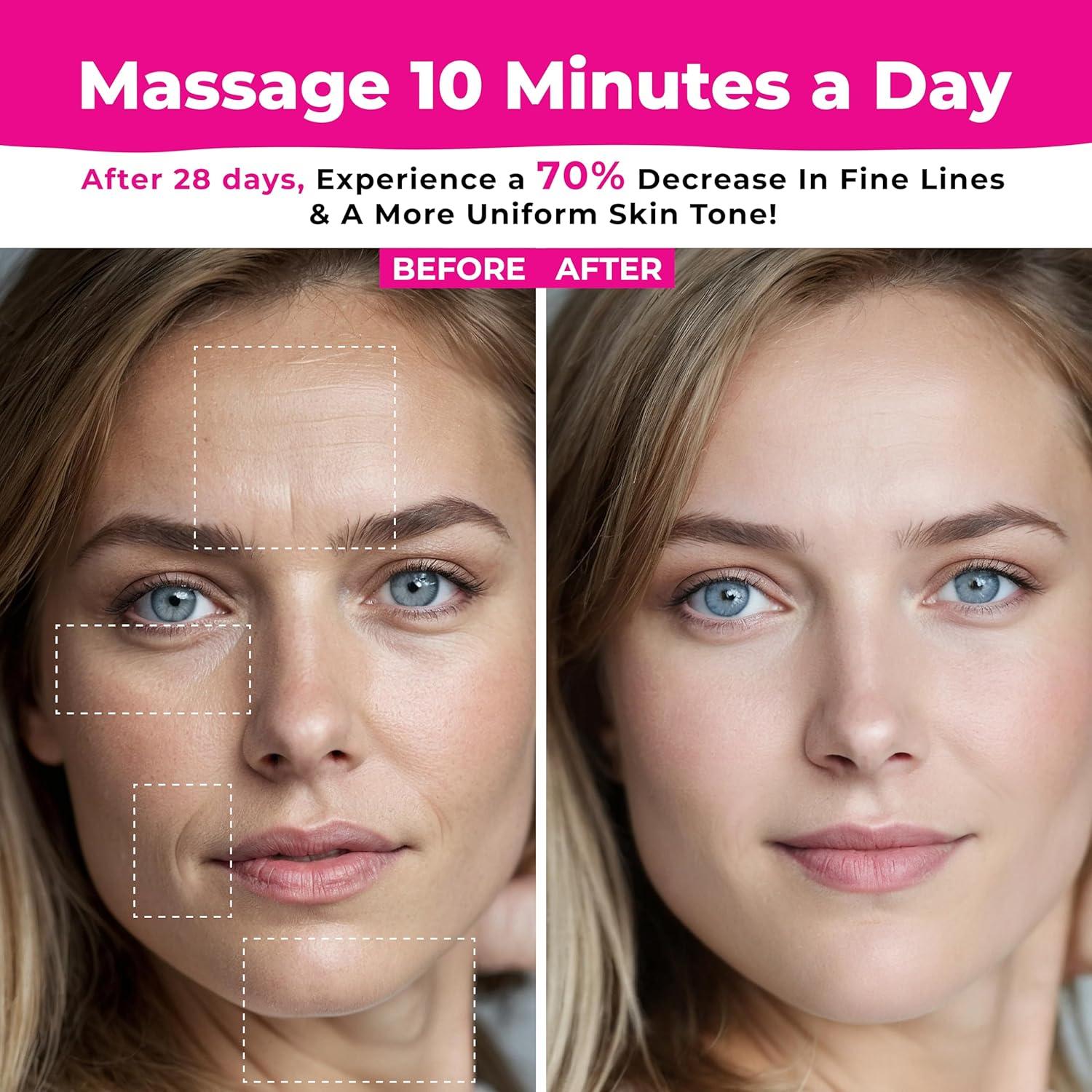 Masajeador Facial Biidey Rosa con Luz Roja y Microcorriente