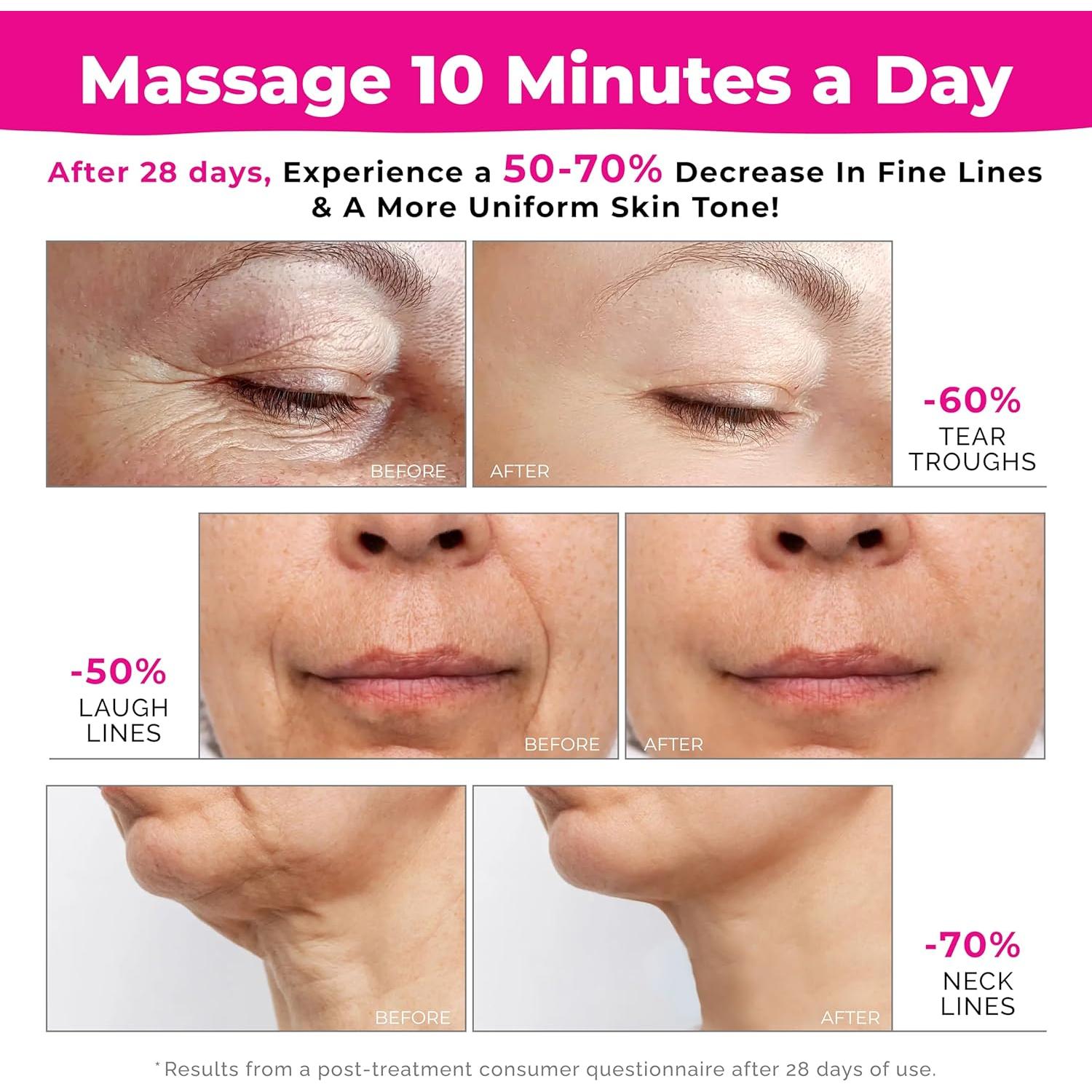 Masajeador Facial Biidey Rosa con Luz Roja y Microcorriente