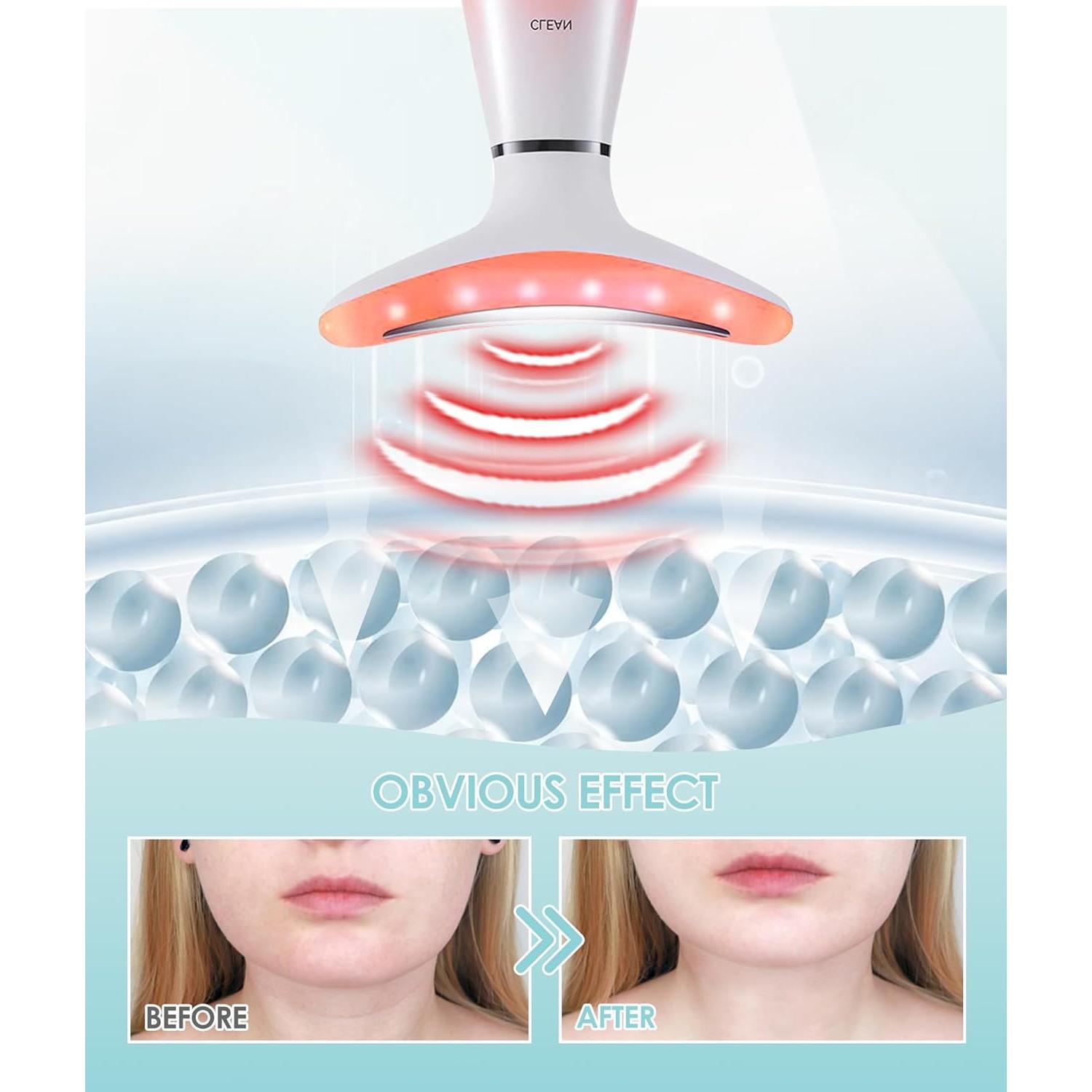 Masajeador Facial Rosa Aozemei 7 Colores con Calor