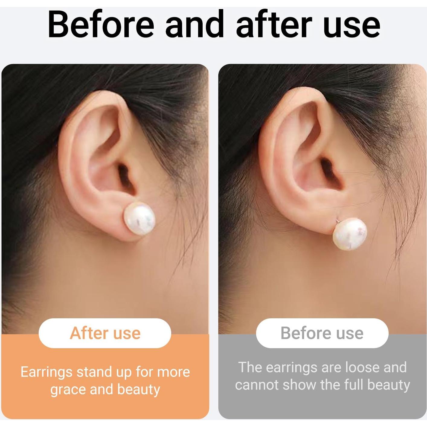 Resortes de Silicona Hipoalergénicos JUNCHONG 12 PCS Oro