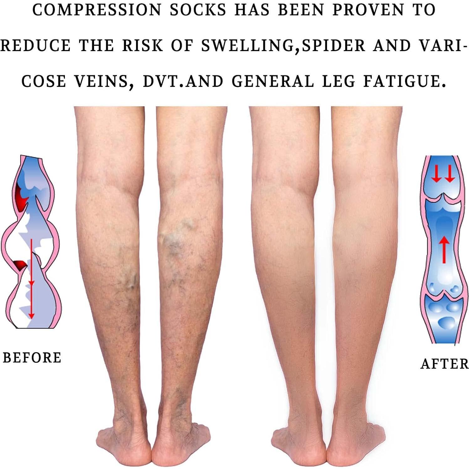 Calcetines de Compresión Médica Lin Performance 20-30 mmHg Beige