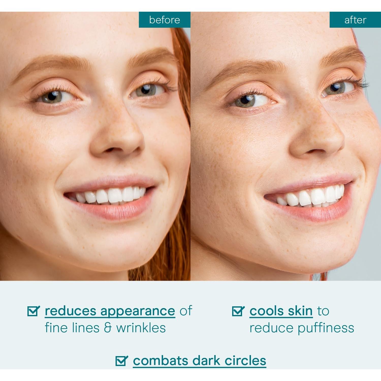 Gel para los ojos Baebody 15 ml - Antienvejecimiento e hidratante