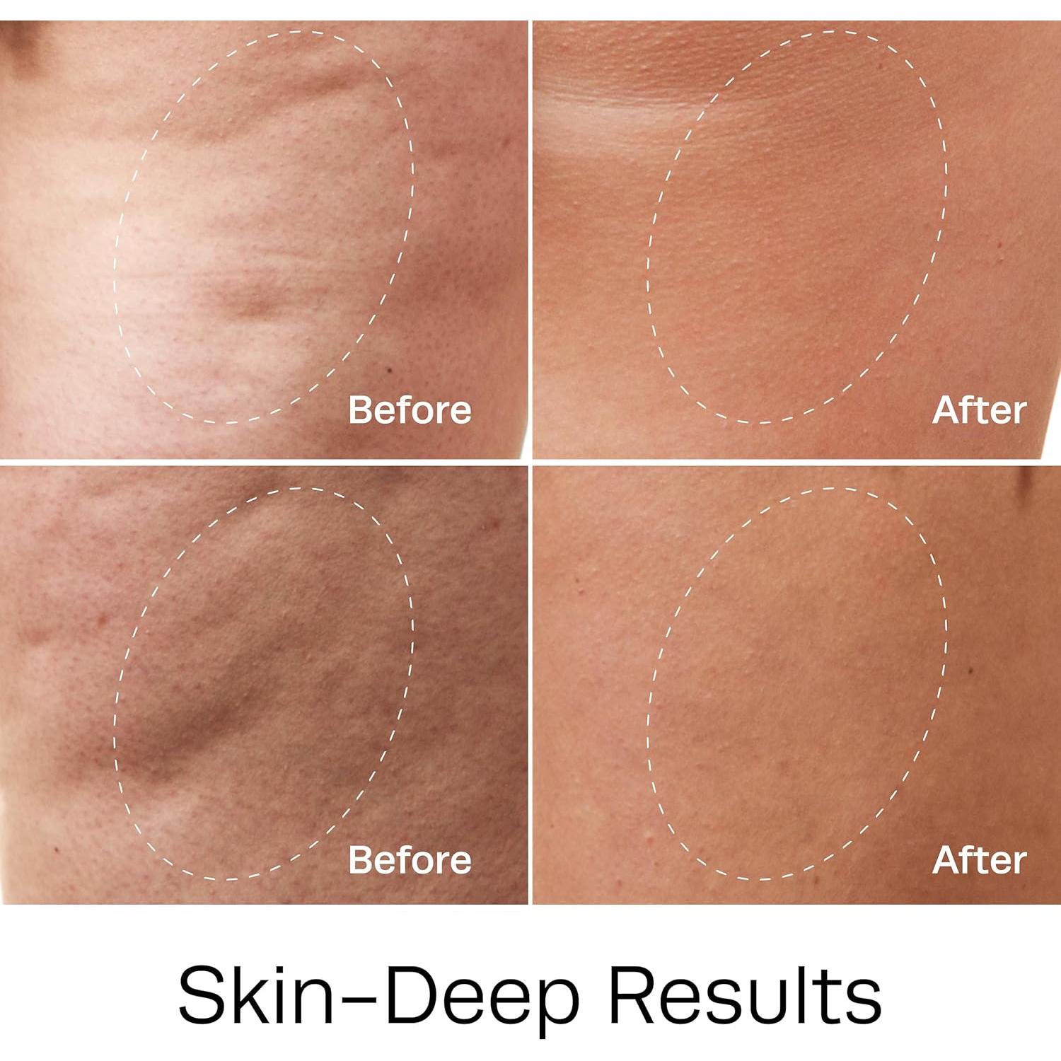 Gel Corporal Anticelulitis Hot Vita 113.4g - Suavizante Natural