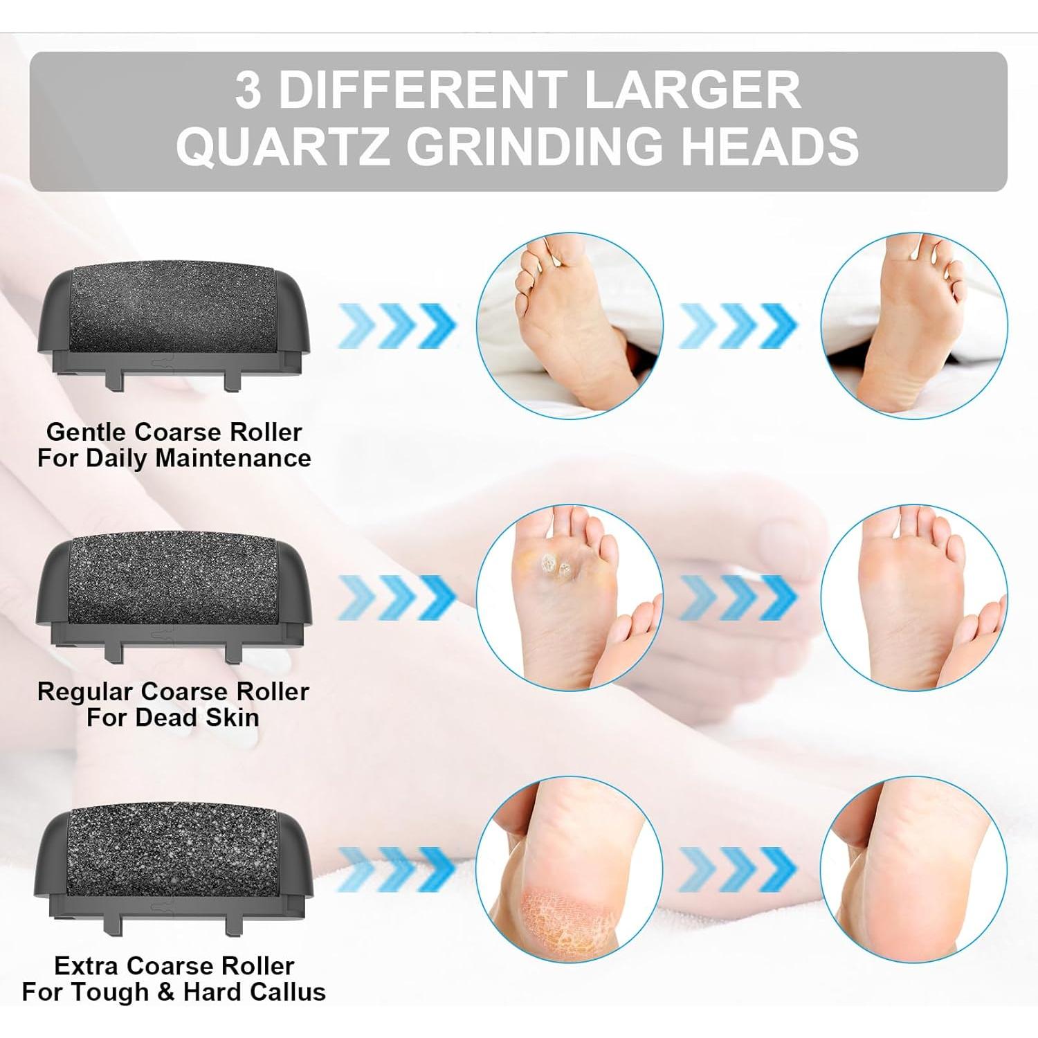 Cabezas de Rodillos de Reemplazo AdamPark 8 Piezas para Pedicura