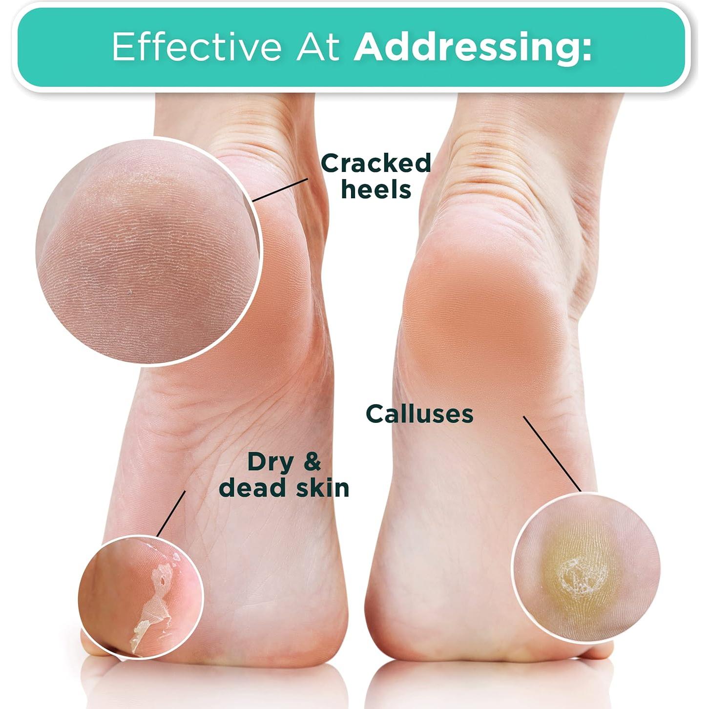 Mascarilla Exfoliante para Pies DERMORA - Aroma Coco - 2 Unidades