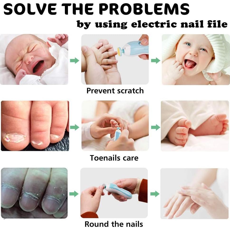 Cortador de Uñas Eléctrico Consevisen 20 en 1 para Bebés y Adultos