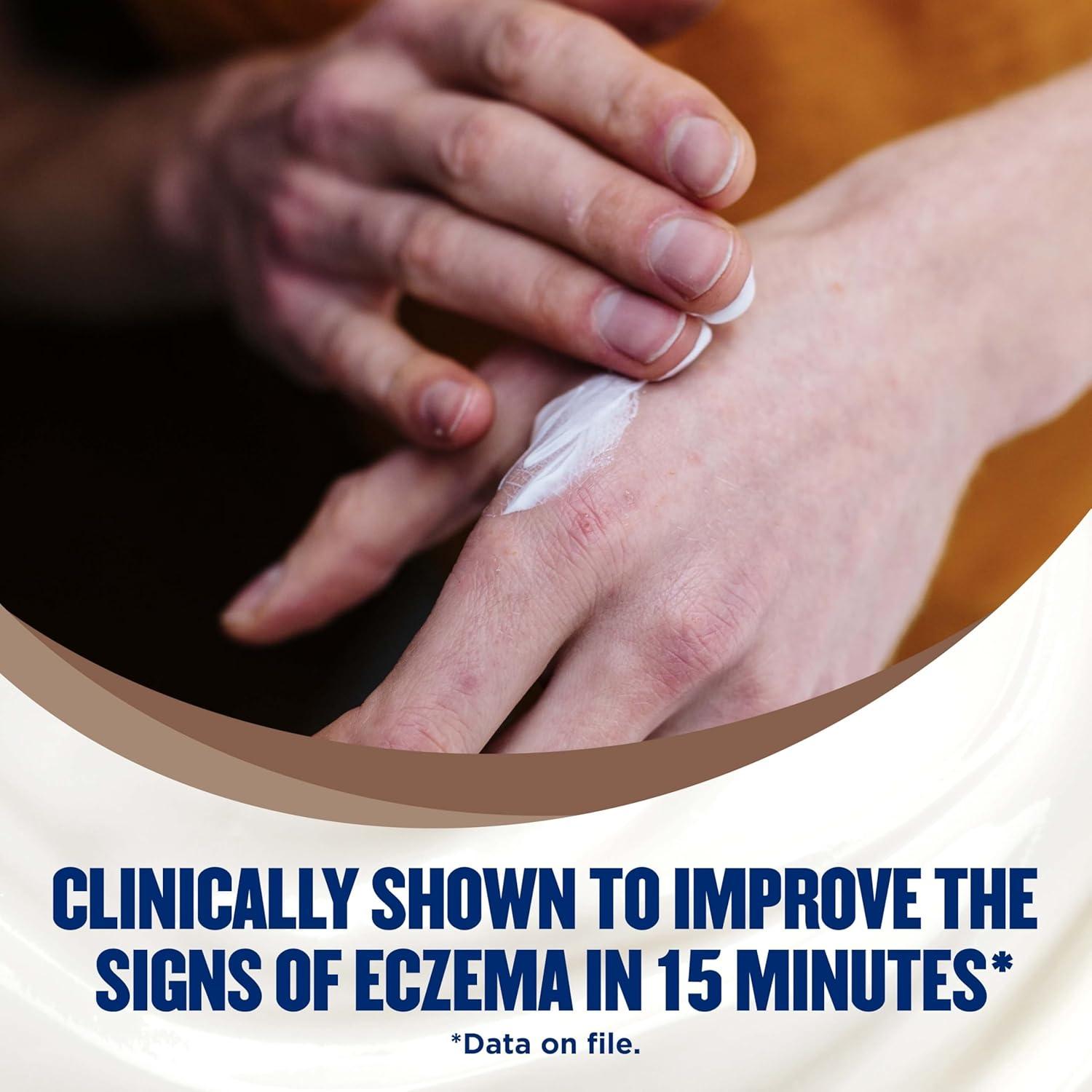 Crema Gold Bond Medicada para Eczema 226.8 g - Alivio Picazón