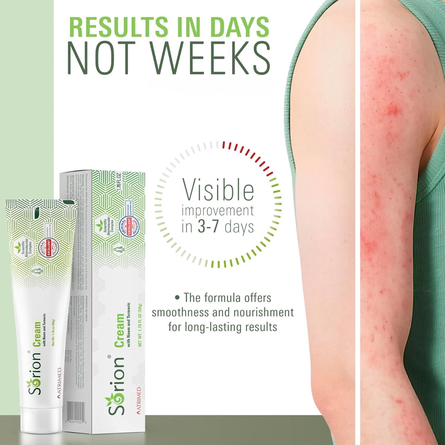 Crema Sorion Hidratante Herbal 51g - Piel Seca y Picazón