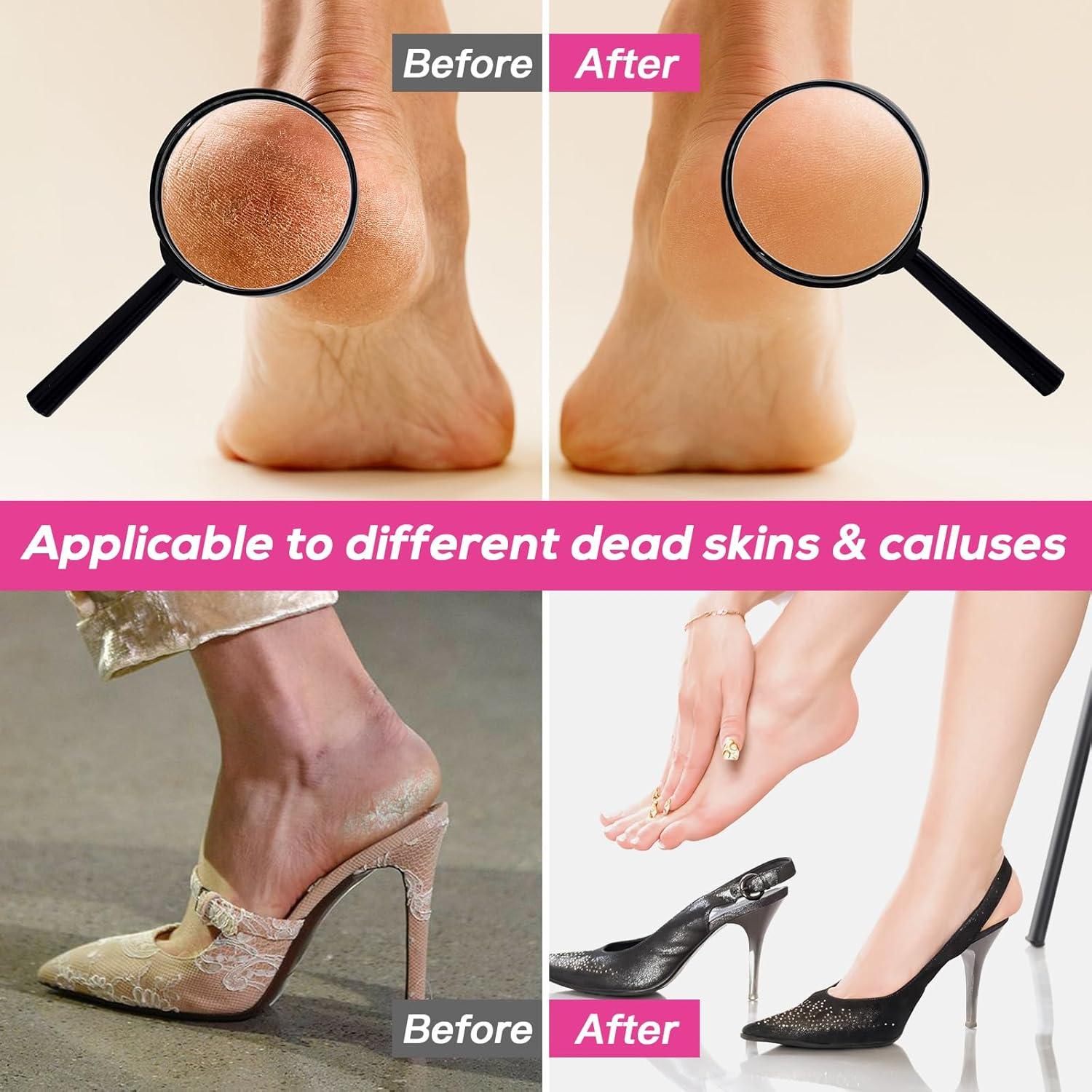 Lima de pies eléctrica KOYYTO con 60 discos de lija negra