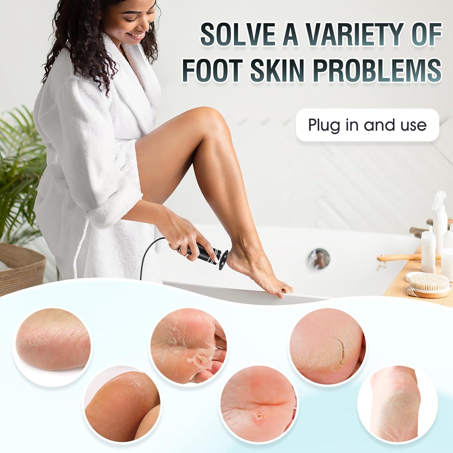 Removedor de Callos Eléctrico KZAOPZ con Velocidad Ajustable y 60 Discos