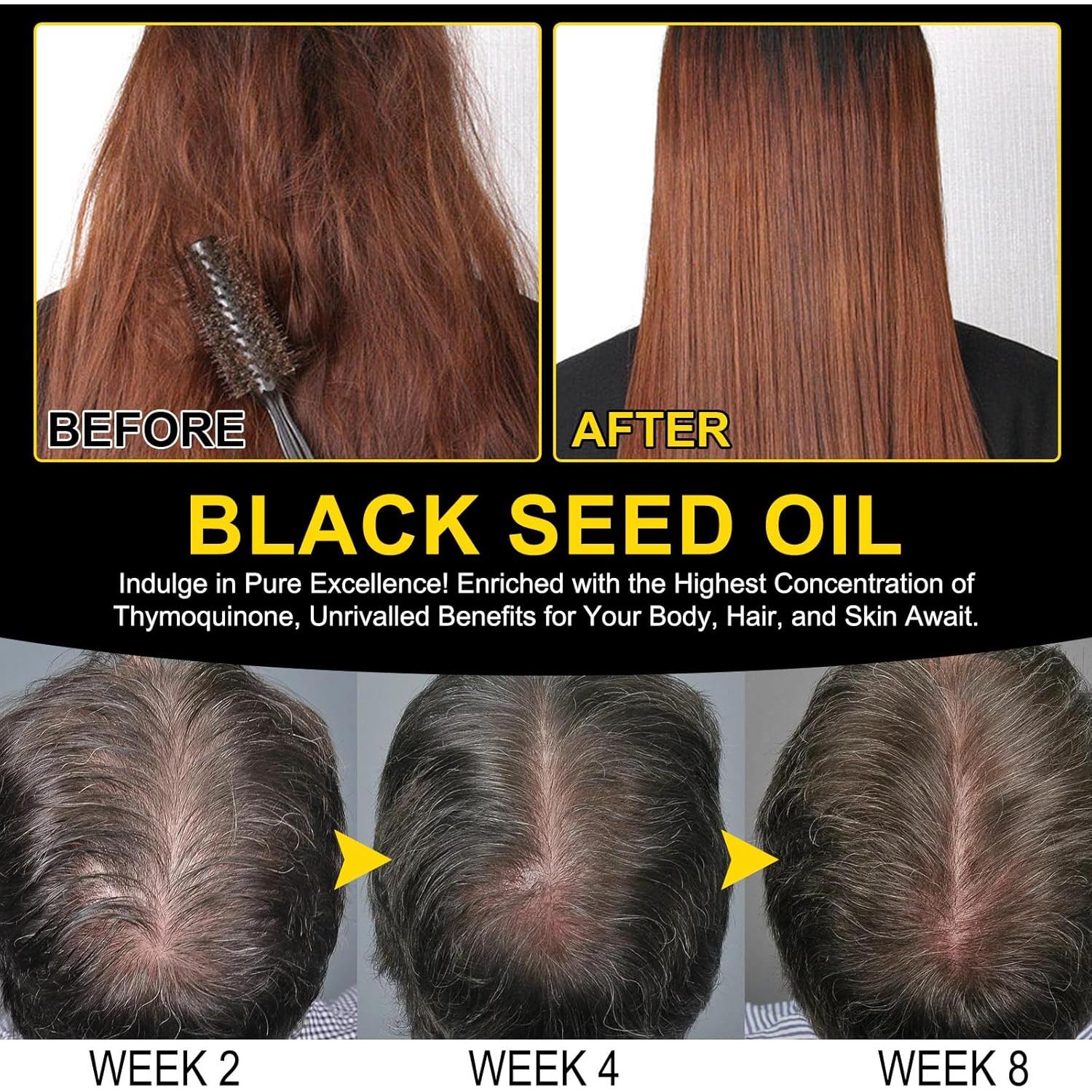 Aceite de Semilla Negra Orgánico Prensado en Frío 60ML x2