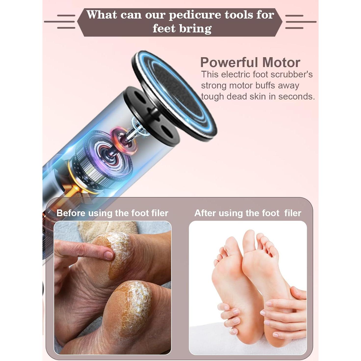 Removedor de Callos Eléctrico MOWLIE con 60 Discos de Lija