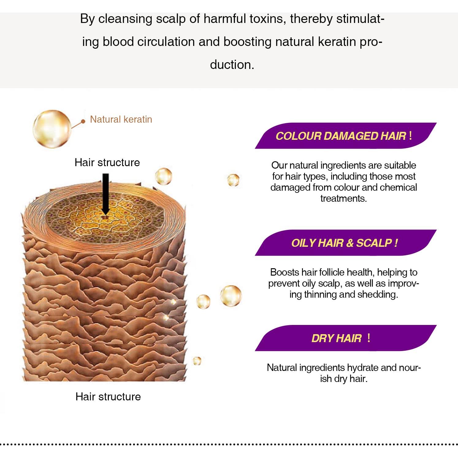 Spray Crecimiento Cabello 3 en 1 Linedson 30ml Romero Cebolla