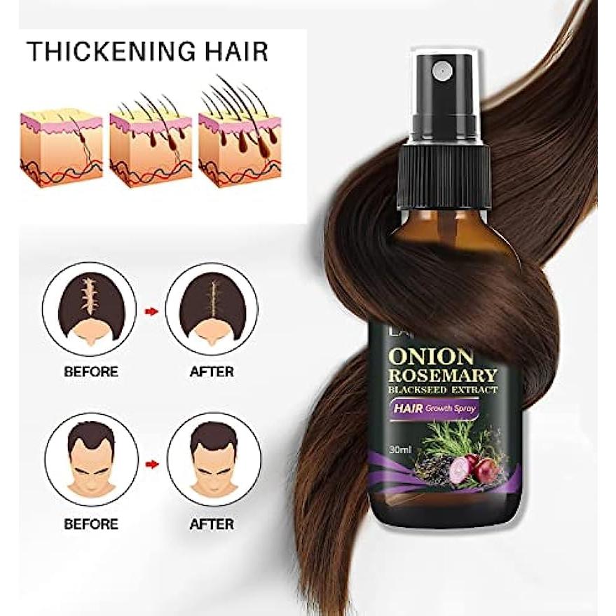 Spray Crecimiento Cabello 3 en 1 Linedson 30ml Romero Cebolla