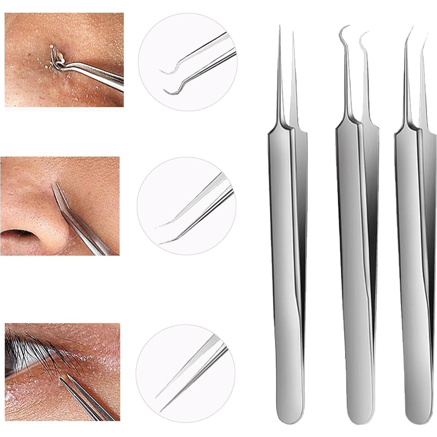 Kit de Pinzas para Puntos Negros WSYUB - Acero Inoxidable 3 en 1
