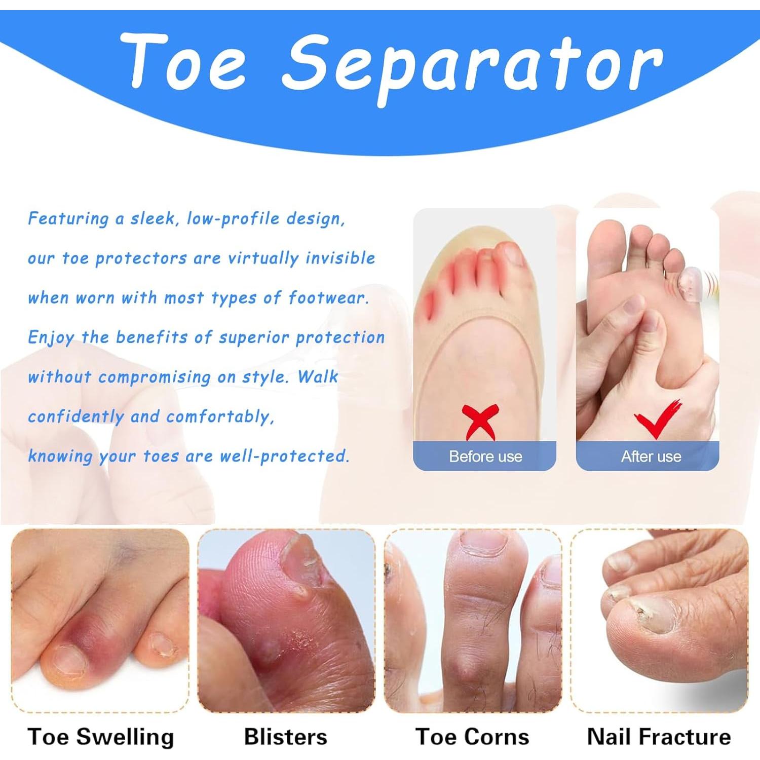 Protectores de Dedos de Silicona SUQILVSI 100PCS Antifricción