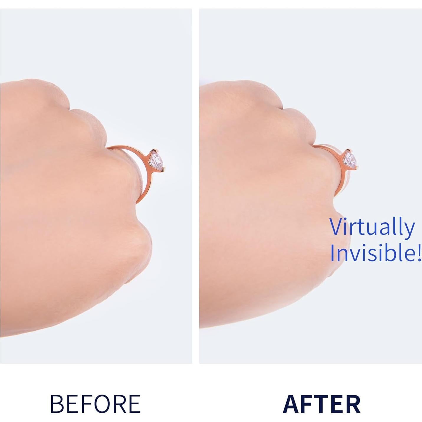 Paquete de 12 Guardas de Anillo de Metal Oro y Plata - Ajustador Invisible