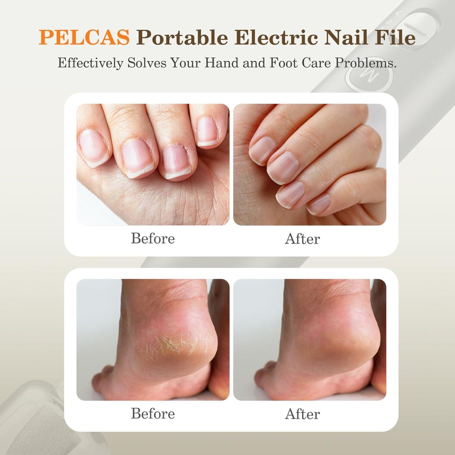 Molinillo de Uñas Eléctrico PELCAS Inalámbrico 10 Velocidades