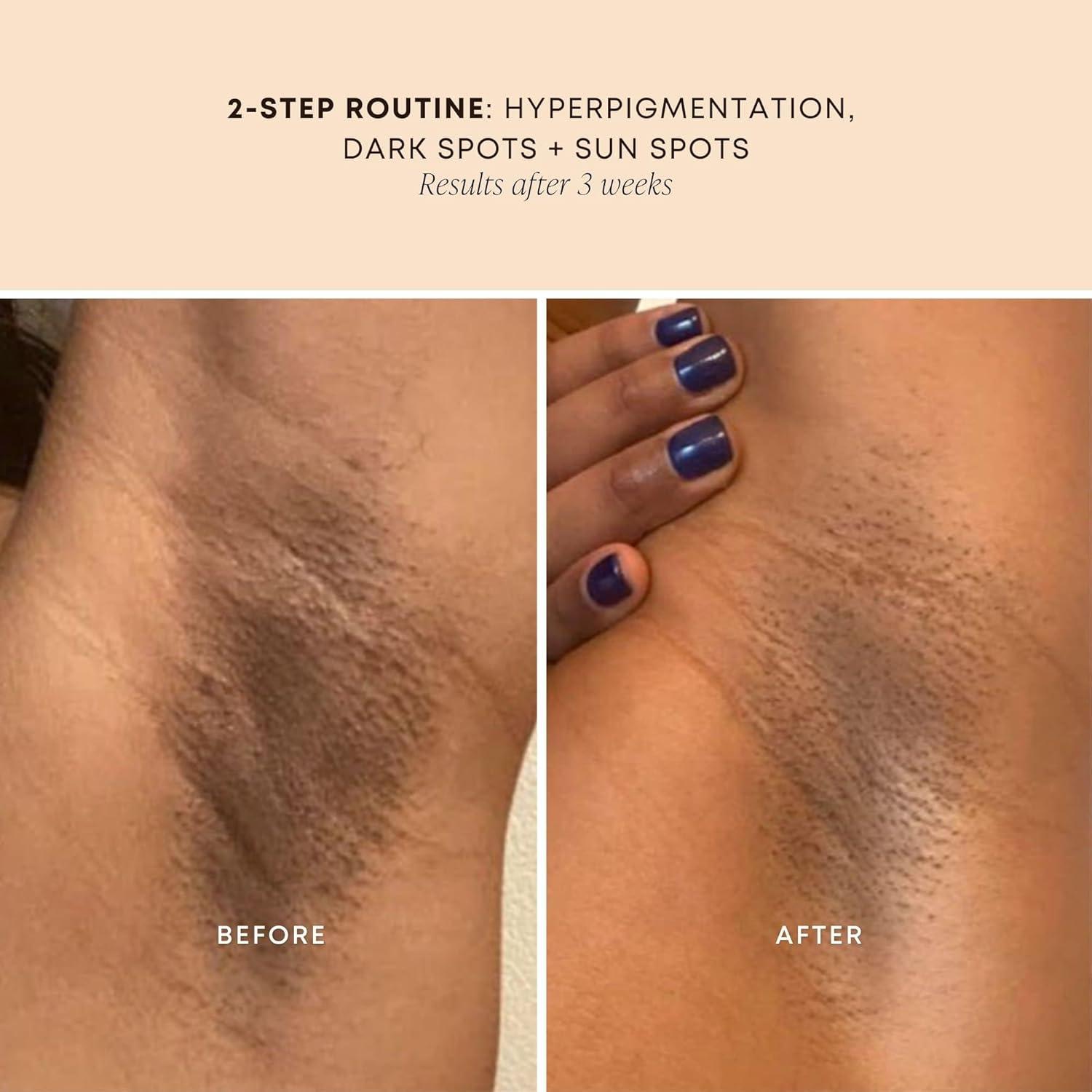 Aceite para Manchas Oscuras Bushbalm 30 ml - Ilumina y Reduce Hiperpigmentación