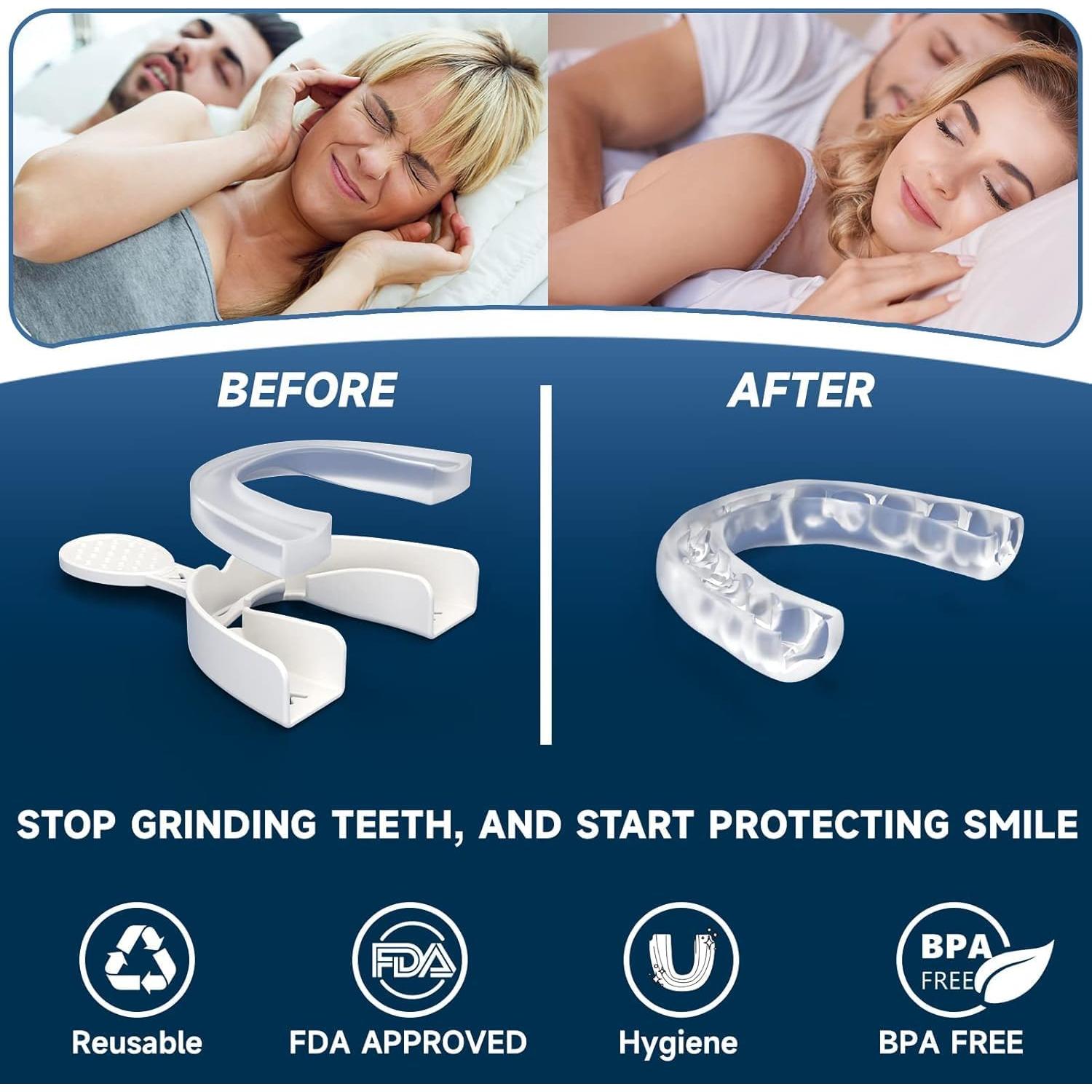 Paquete de 2 Protectores Nocturnos Natrlteeth para Bruxismo