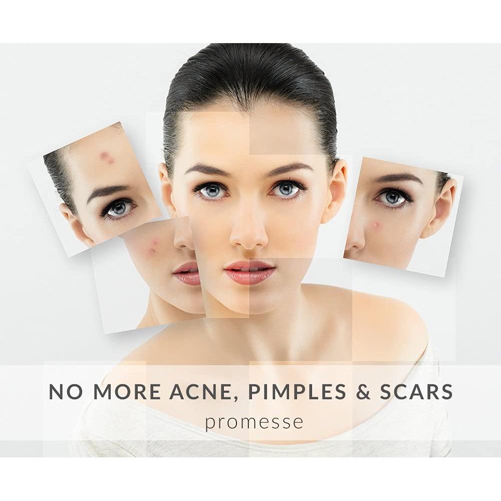 Limpiador Facial Promesse 118ml - Control de Acné y Anti-Envejecimiento