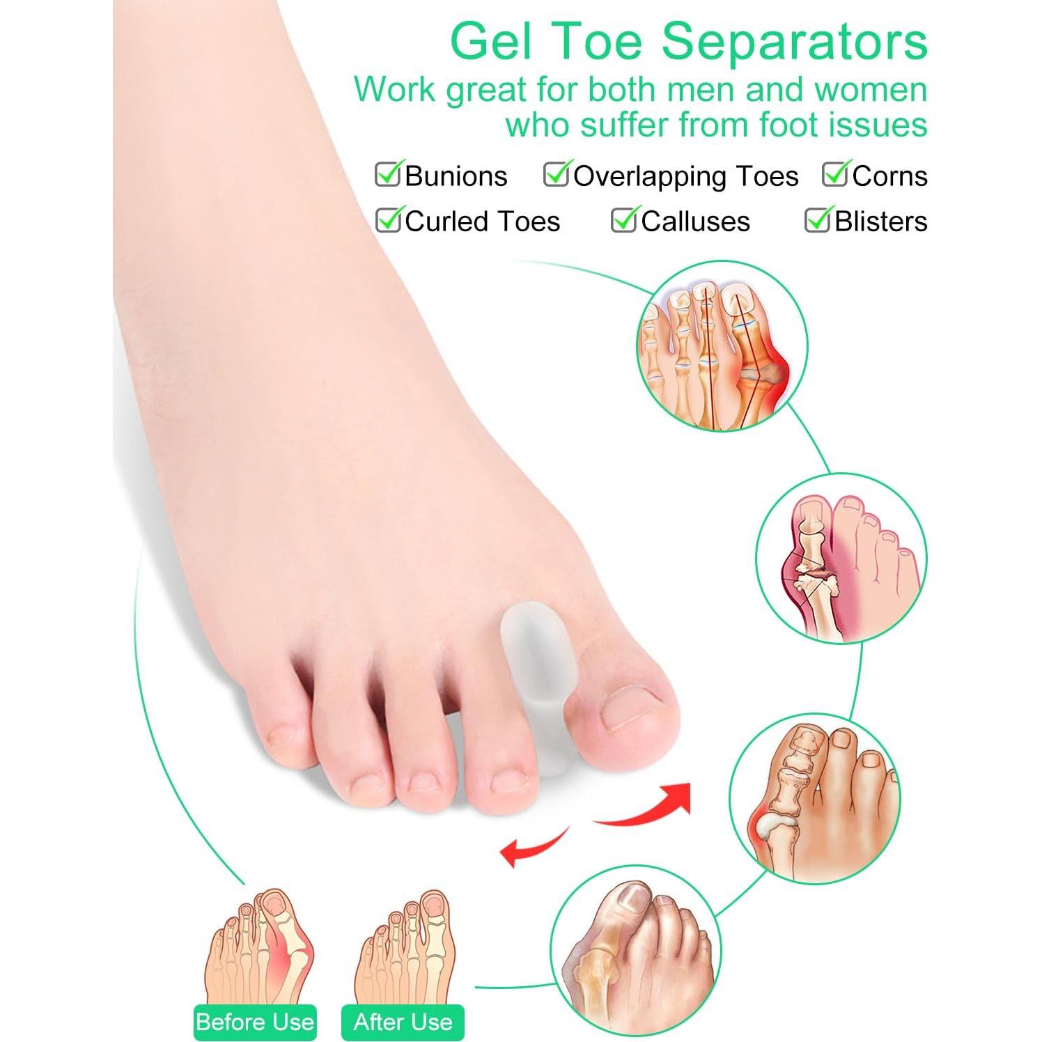 Separadores de dedos de gel Samaya Home - 12 piezas pequeños