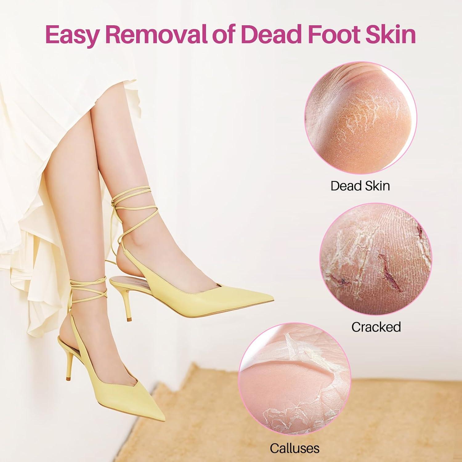 Discos de Papel de Lija para Lima Eléctrica LIONVISON 60 Pcs