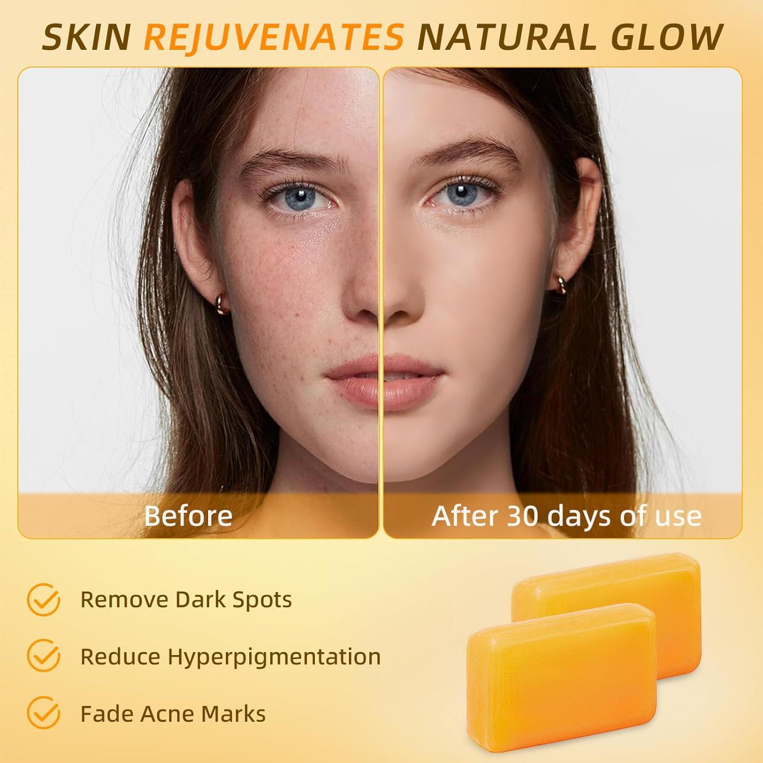 Jabón de Cúrcuma y Ácido Kójico Senzilo - 2 Barras 105g