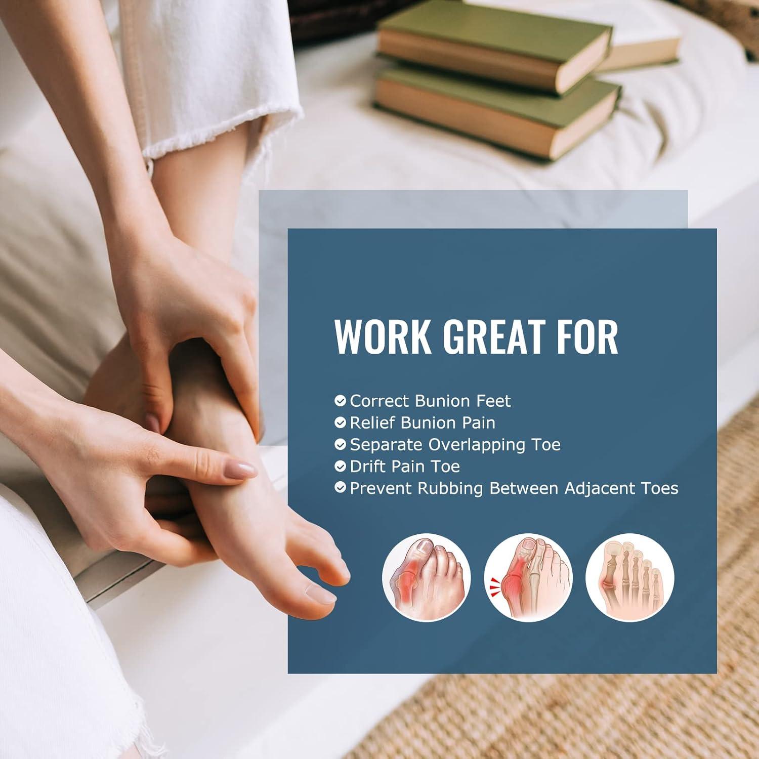 Separadores de Dedos de Gel Welnove - 12 Almohadillas para Juanetes