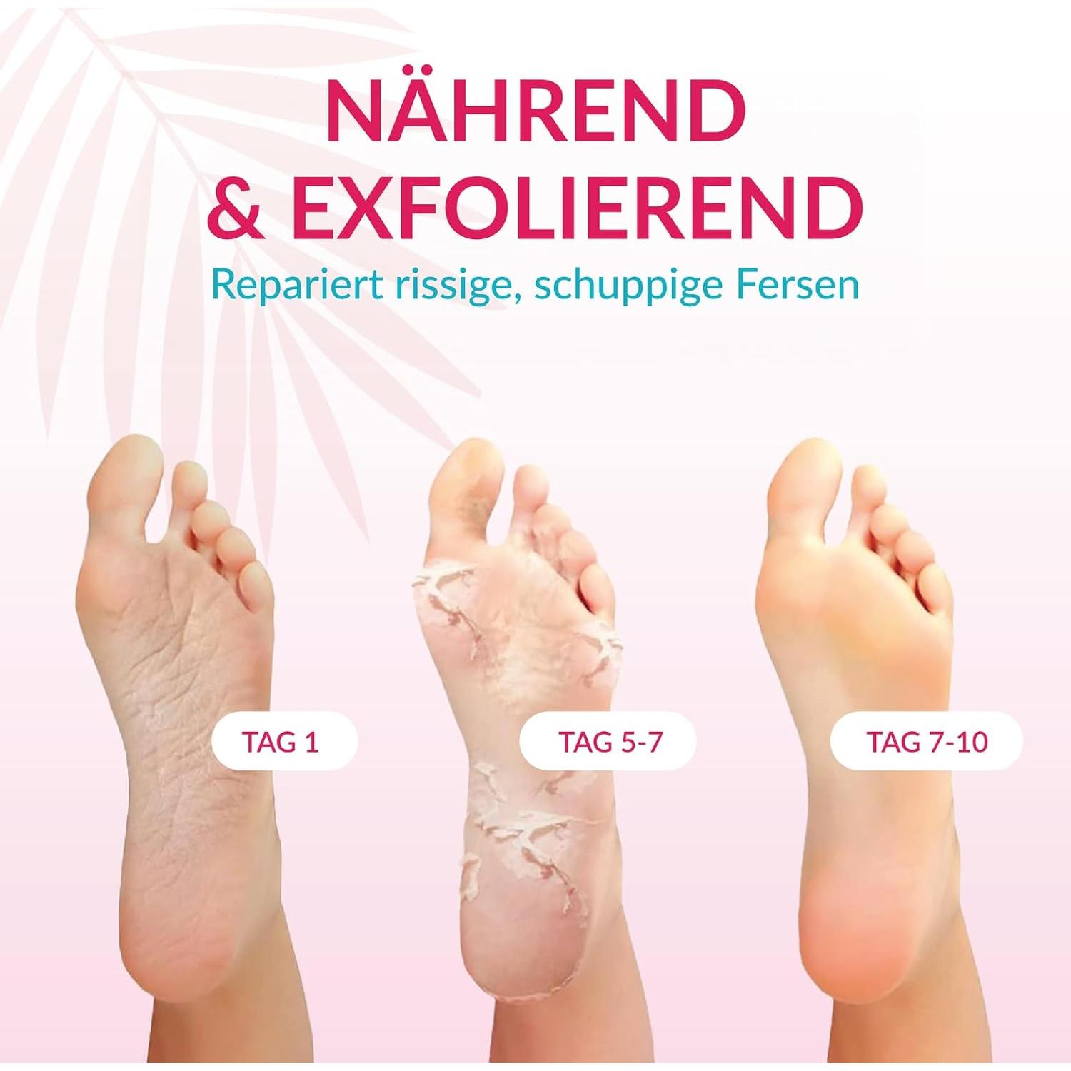 Mascarilla Exfoliante para Pies Summer Foot - 1 Par - Extractos de Pepino y Urea