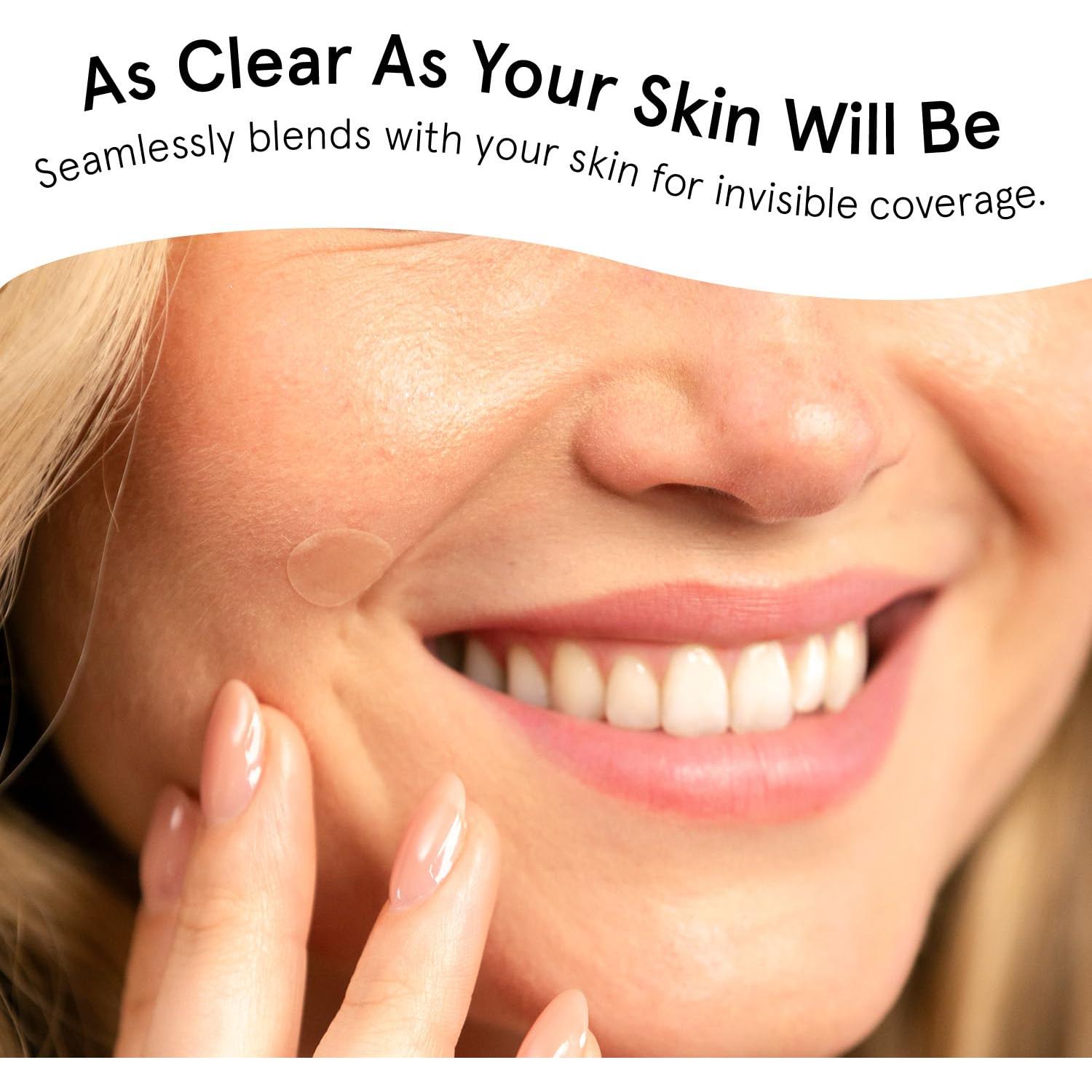 Parches para Acné Hidrocoloides Grace & Stella - 36 Piezas