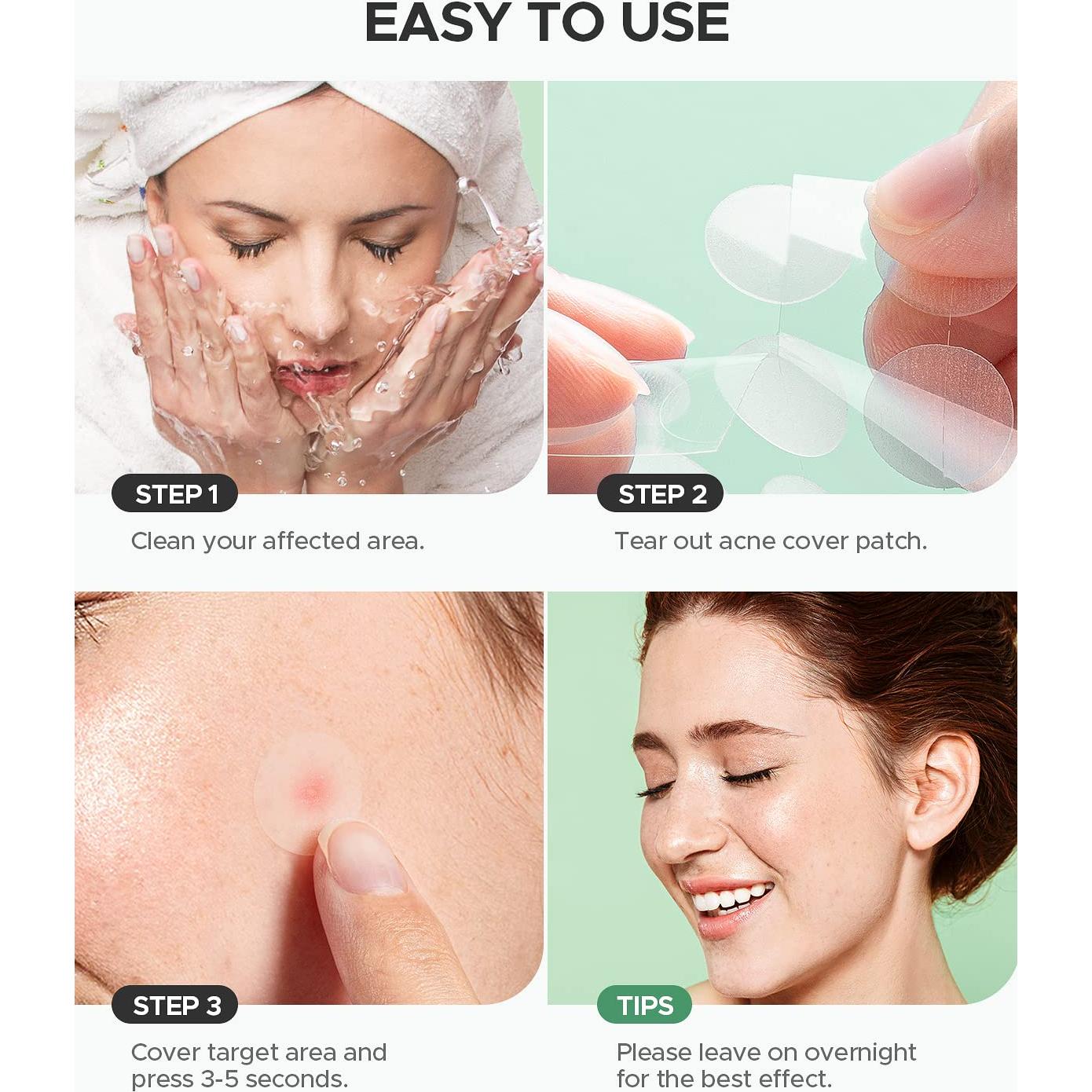 Parche para Granos de Acné ZATKTK - 180 Unidades, 4 Tamaños