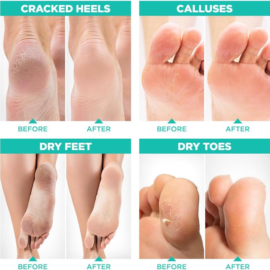 Máscara Exfoliante para Pies Lavinso - Paquete de 2 Aloe Vera