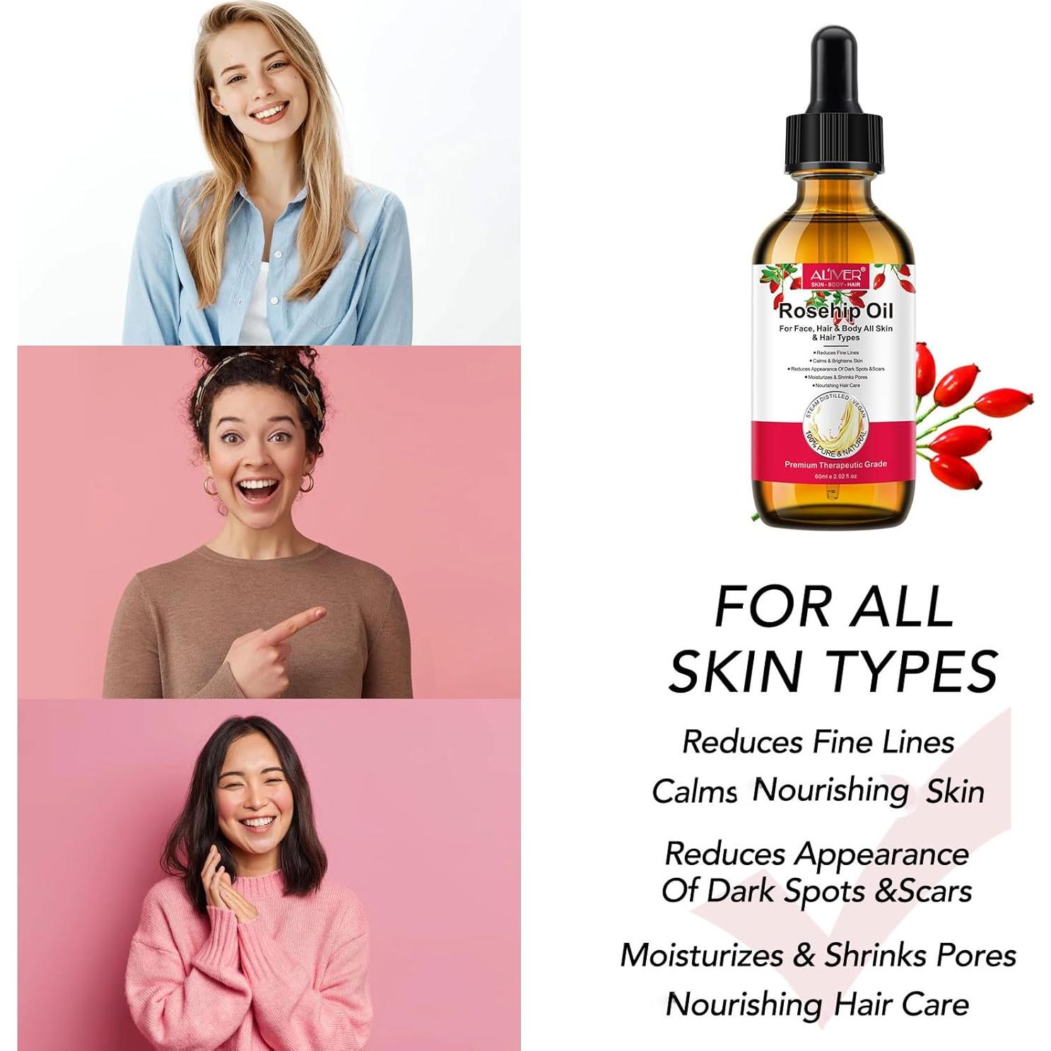 Aceite de Rosa Mosqueta Orgánico 100% Puro 59.87 ml - Onznoz