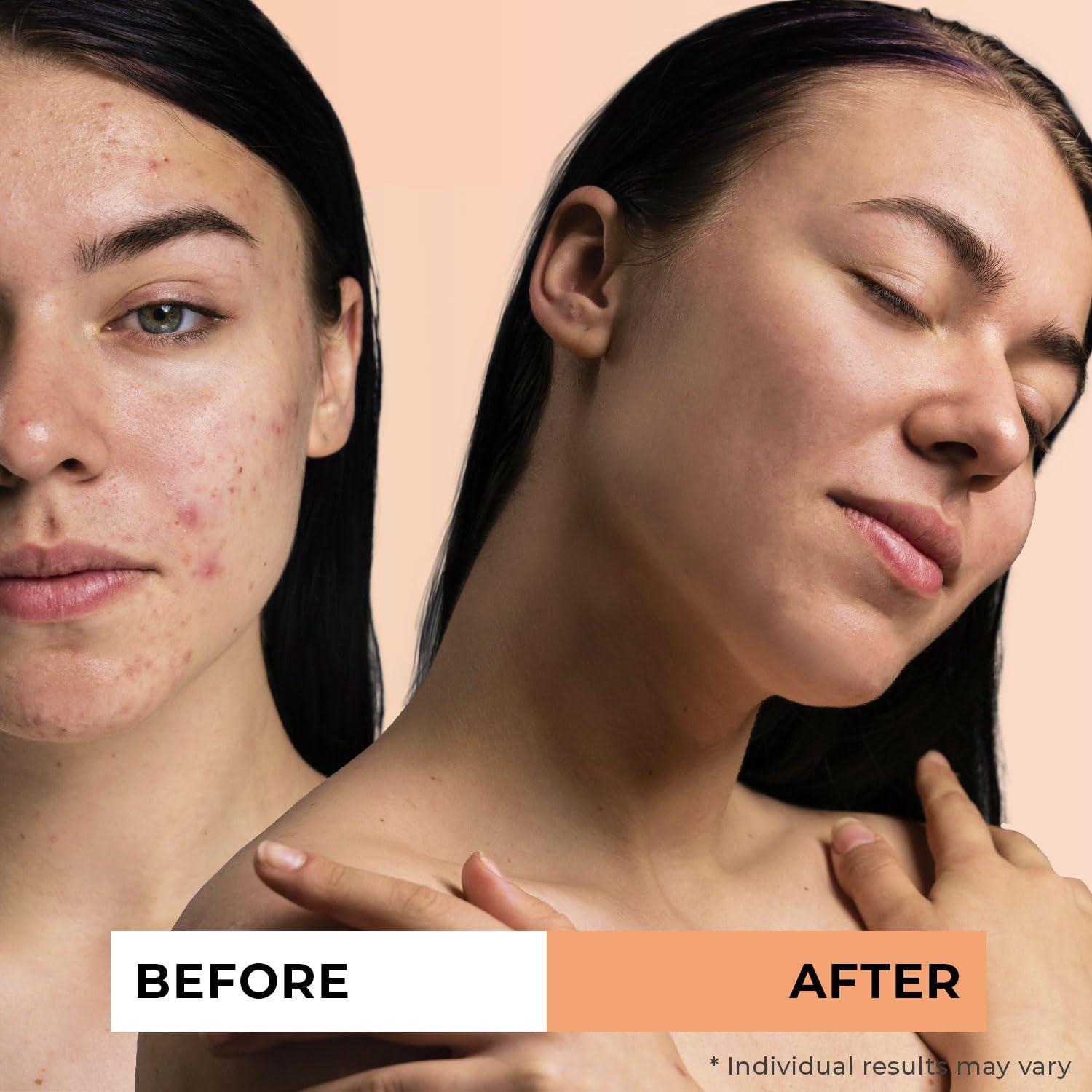 Aceite de Espino Marino Orgánico Jeune Naturelle 59 ml Puro