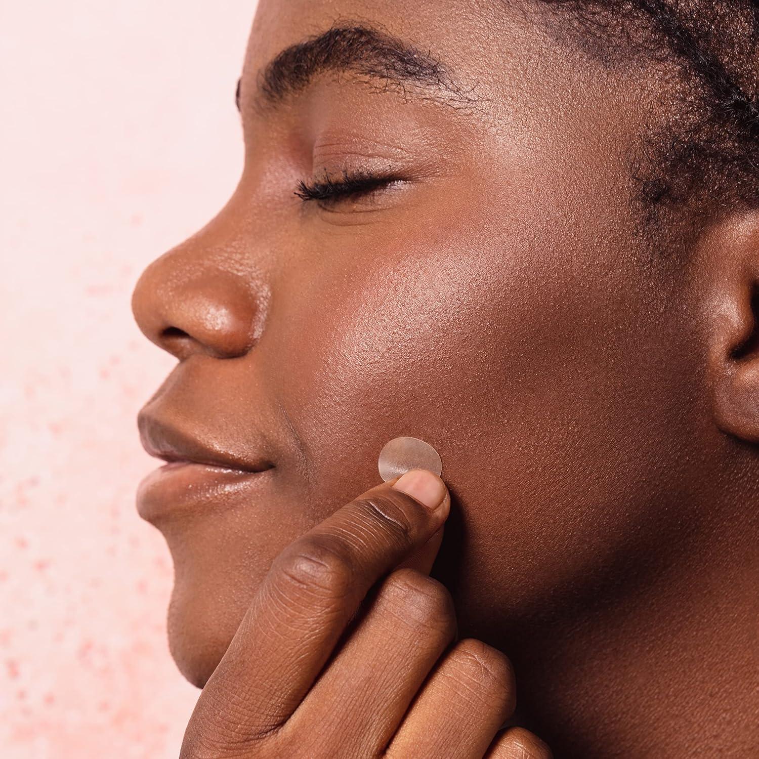 Parches para Granitos Alba Botanica Acnedote - 40 Unidades