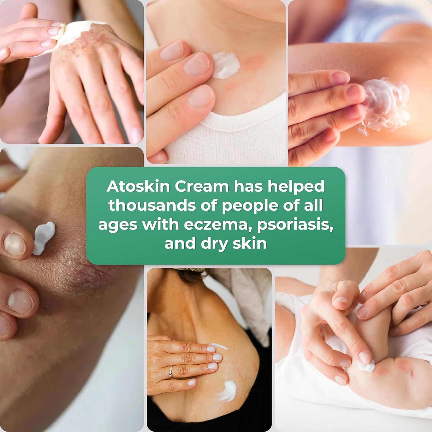 Crema Atoskin para Eczema y Dermatitis - 40.8 g