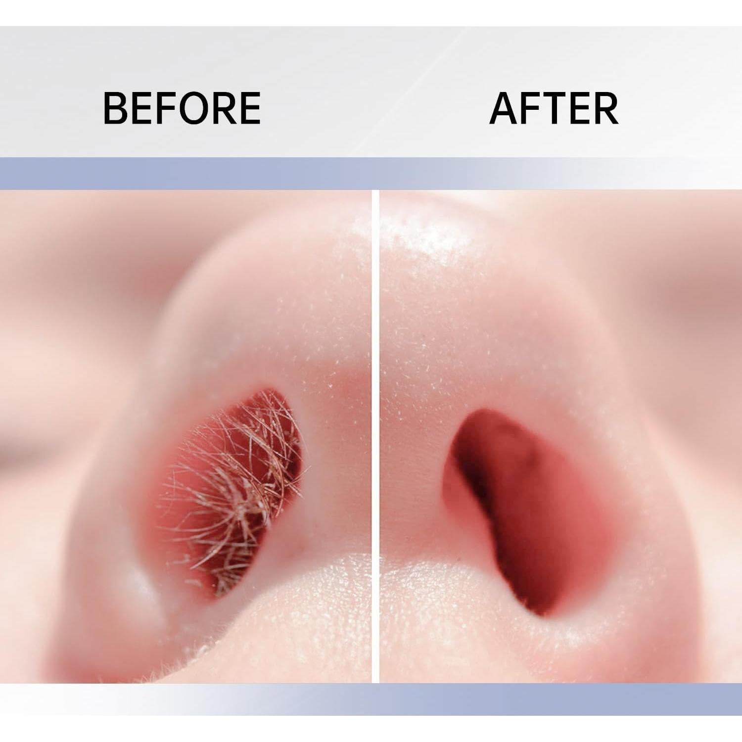 Cortador de Vello Nasal 2-en-1 Truvenum, 3 Piezas, Manual