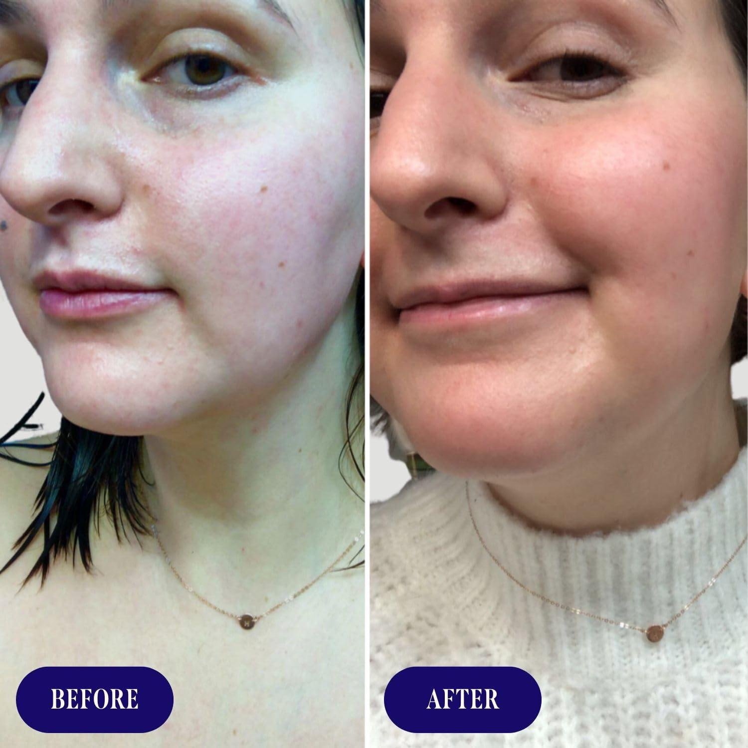 Suero Facial Reafirmante Three Ships Aceite Rosa Mosqueta 29.57 ml