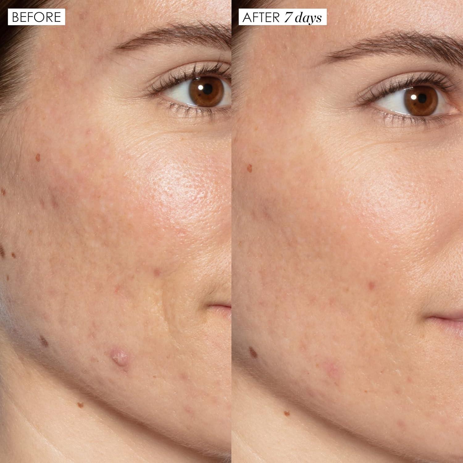 Tratamiento Facial Ácido Láctico Good Genes 120g - Sunday Riley