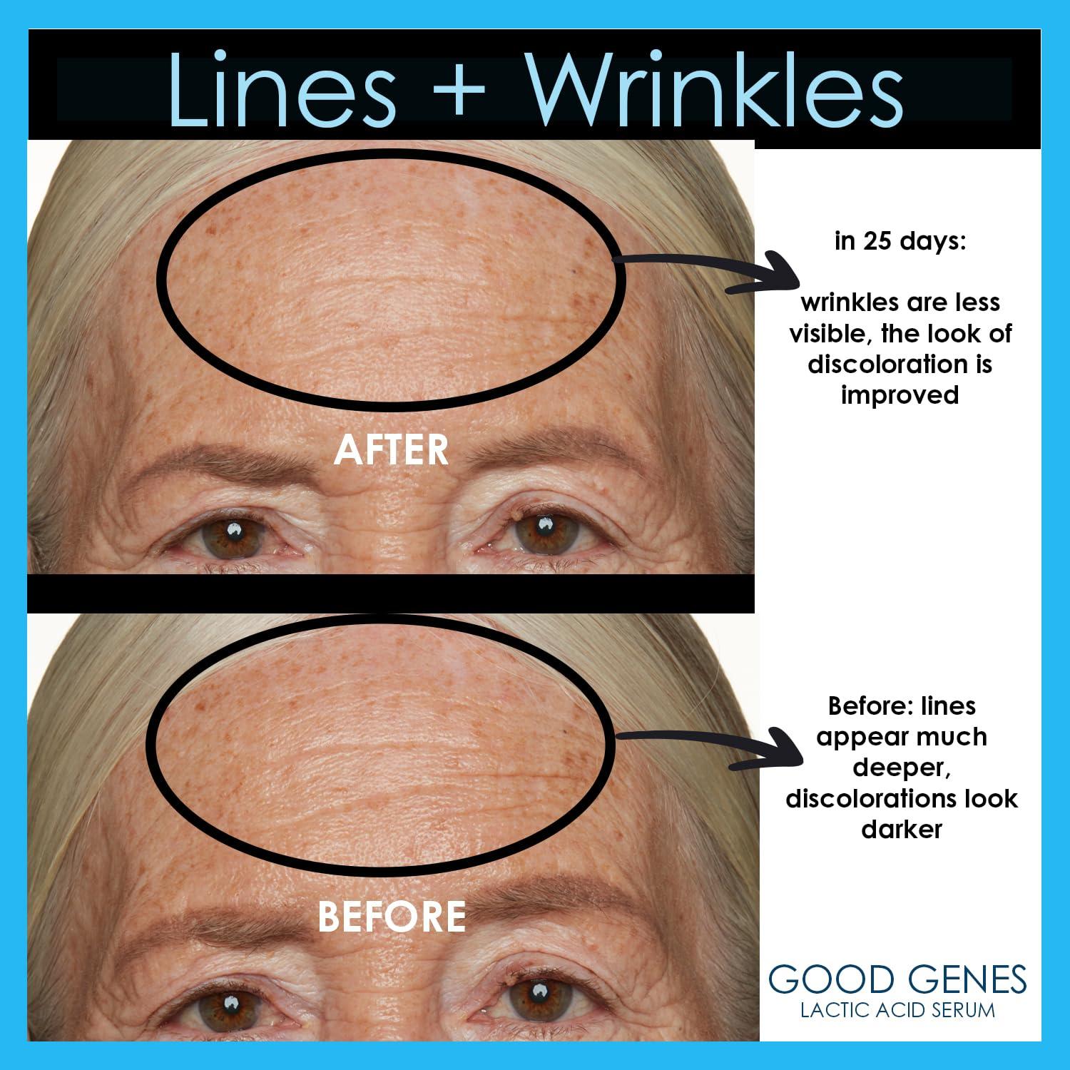 Tratamiento Facial Ácido Láctico Good Genes 120g - Sunday Riley