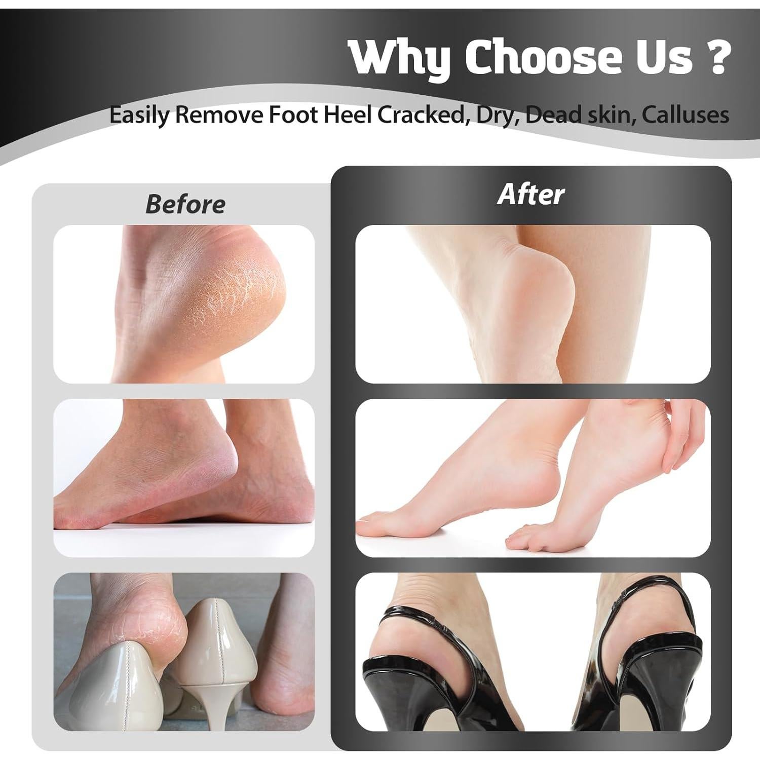 Removedor de Callos Eléctrico HsnChrm con 60 Discos de Lija