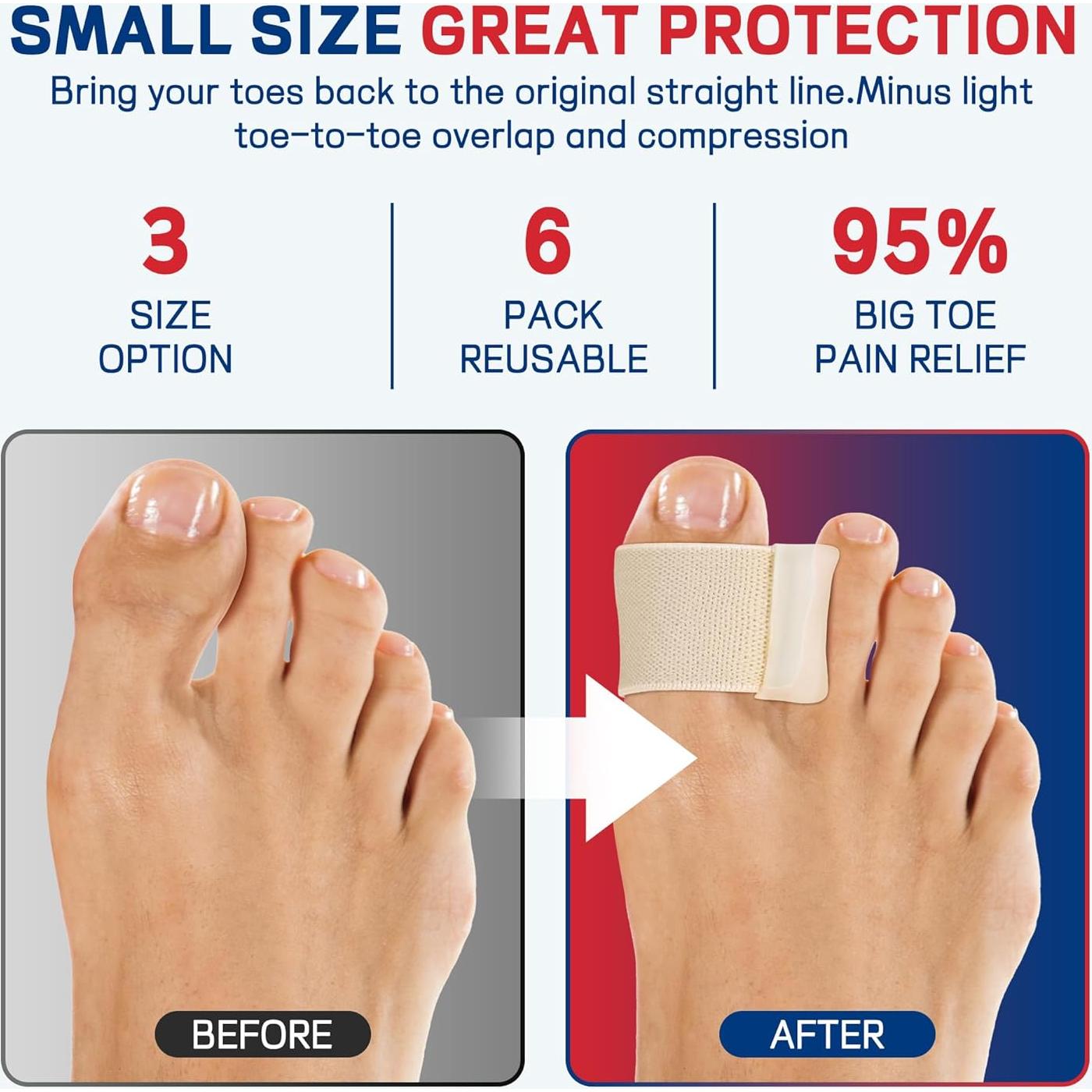 Separadores de Dedo Gordo FULEEAN para Juanetes - Alivio Dolor