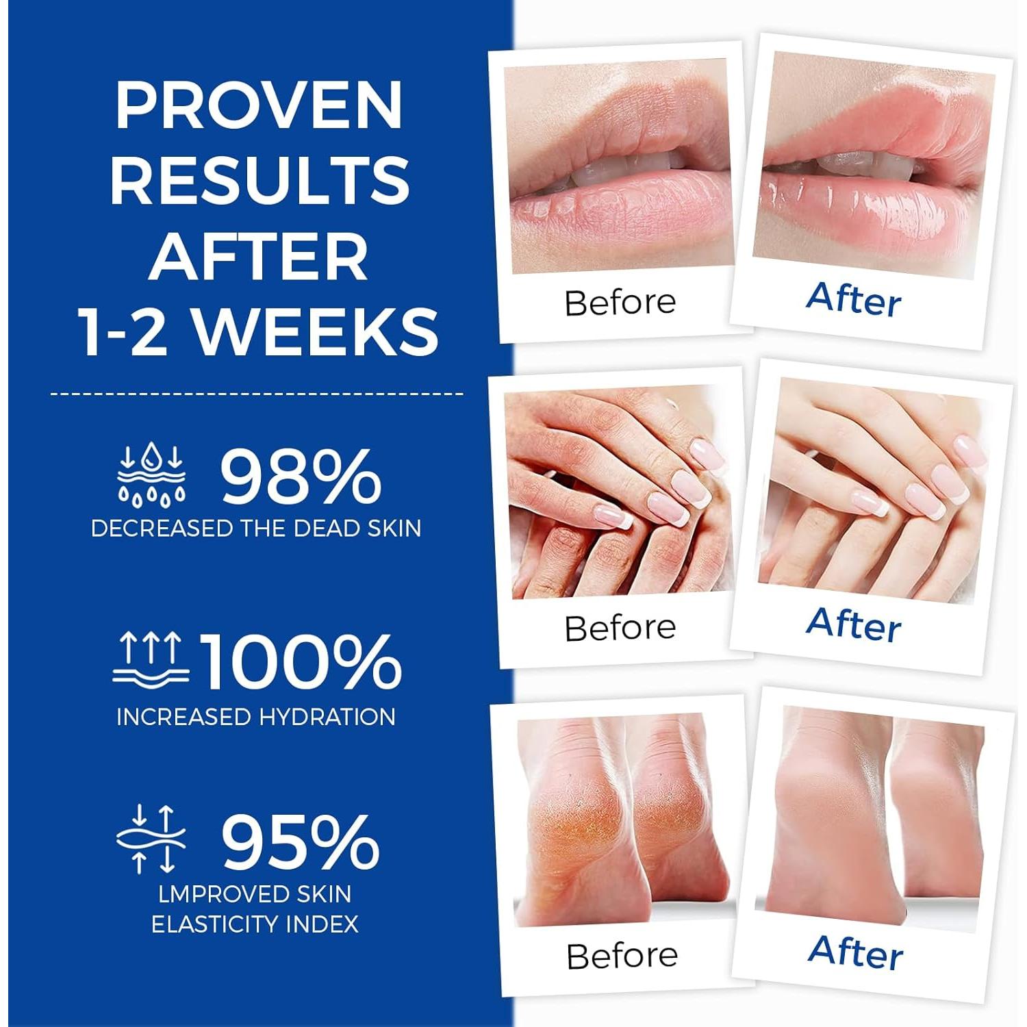 Ungüento Sanador OUKEYA 311g - Hidratante Piel Seca y Agrietada