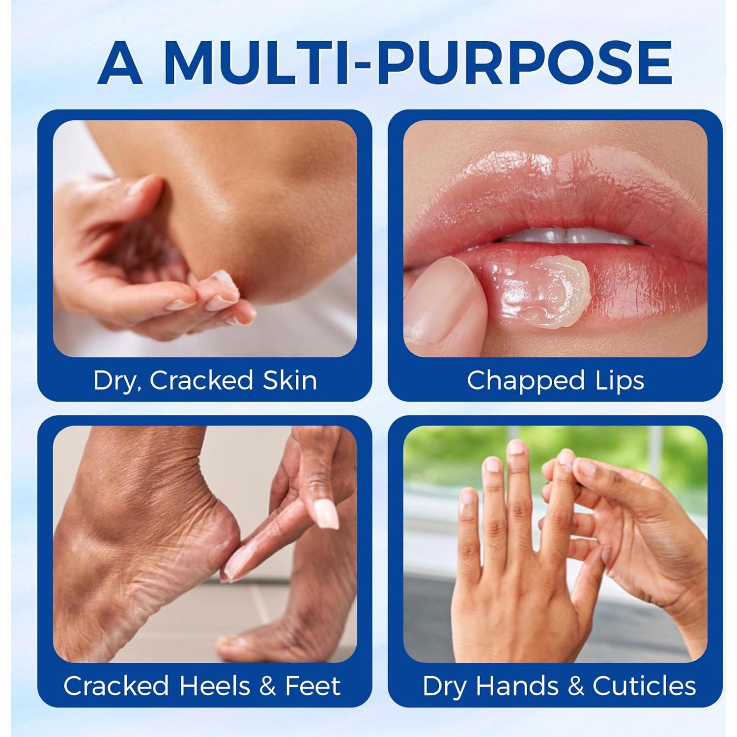 Ungüento Sanador OUKEYA 311g - Hidratante Piel Seca y Agrietada