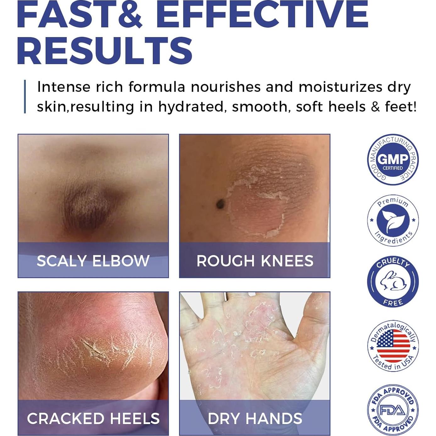 Crema de Urea OUKEYA 42% + Ácido Salicílico 2% - 2 Piezas