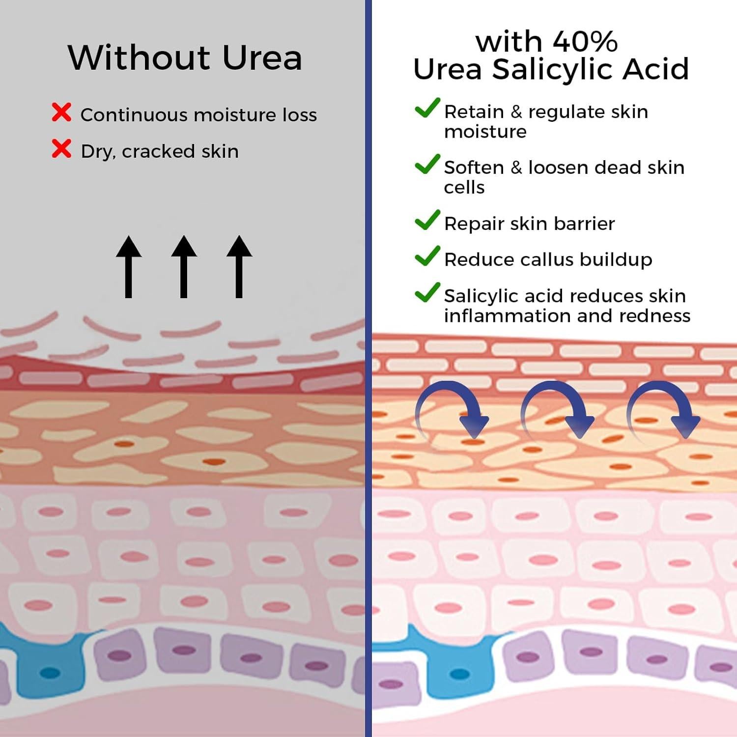 Crema de Urea OUKEYA 42% + Ácido Salicílico 2% - 2 Piezas